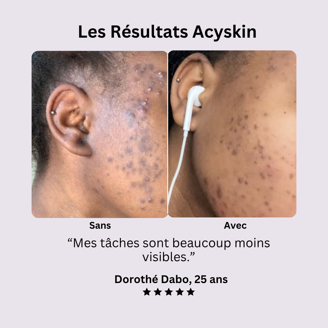 L'Exoliant Anti-taches au Curcuma