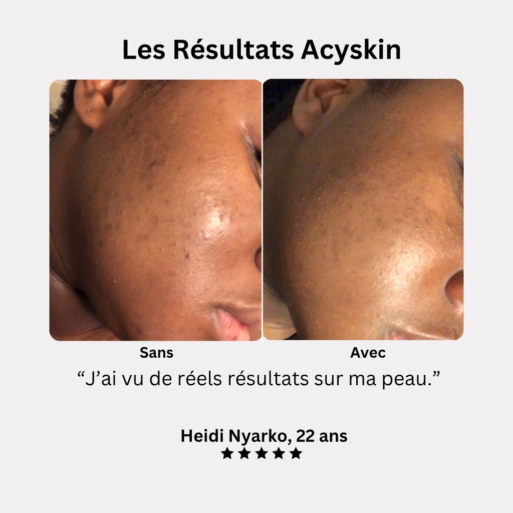 L'Exoliant Anti-taches au Curcuma