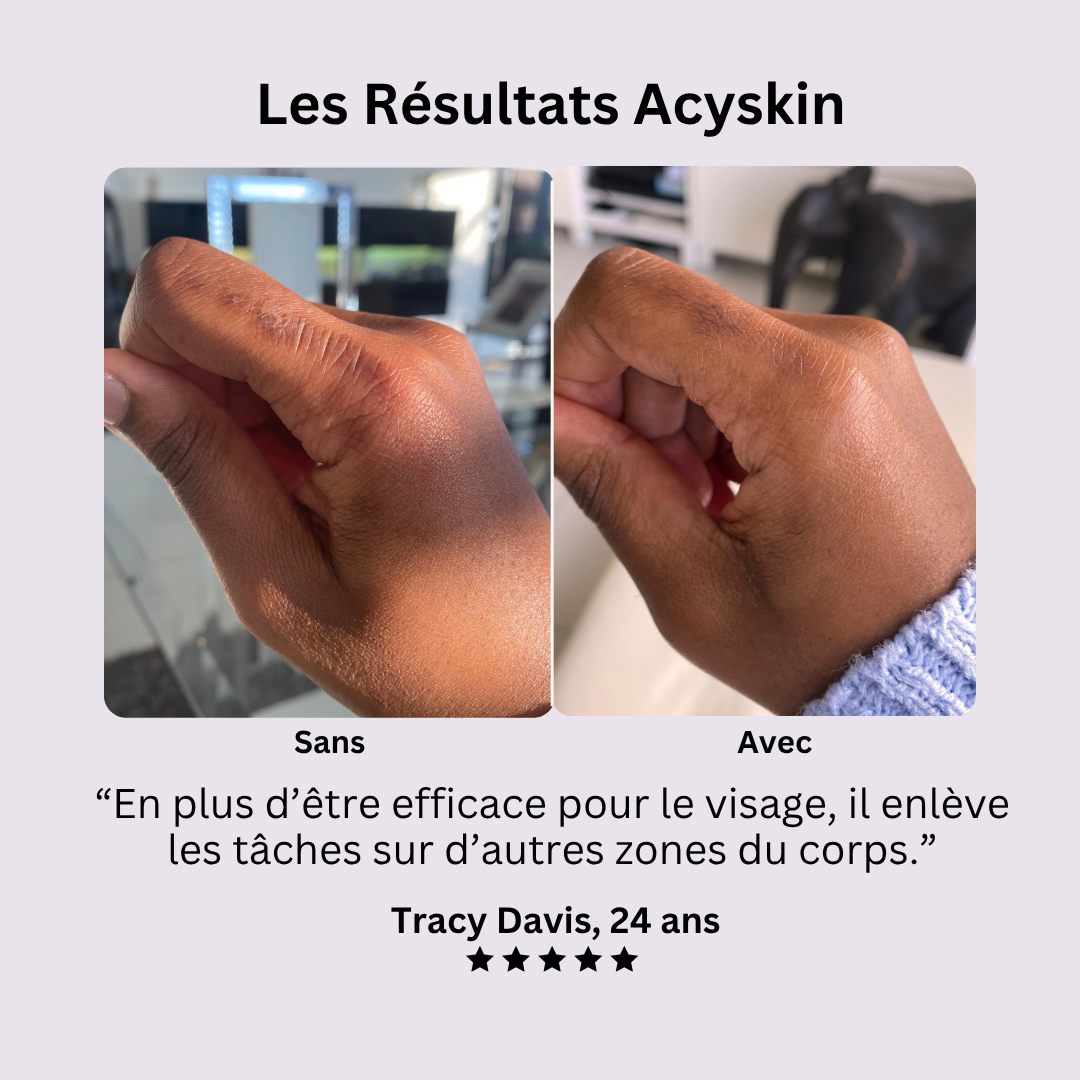 L'Exoliant Anti-taches au Curcuma
